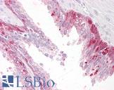 PHLDA2 / TSSC3 Antibody - Anti-PHLDA2 antibody IHC of human prostate. Immunohistochemistry of formalin-fixed, paraffin-embedded tissue after heat-induced antigen retrieval. Antibody concentration 3.75 ug/ml.