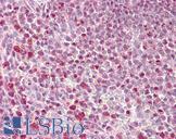 PHLPP2 / PHLPPL Antibody - Anti-PHLPP2 / PHLPPL antibody IHC staining of human spleen. Immunohistochemistry of formalin-fixed, paraffin-embedded tissue after heat-induced antigen retrieval.