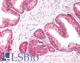 PICK1 Antibody - Human Prostate: Formalin-Fixed, Paraffin-Embedded (FFPE)
