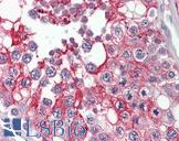 PIK3CG / PI3K Gamma Antibody - Human Testis: Formalin-Fixed, Paraffin-Embedded (FFPE)