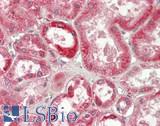 PIKFYVE / PIP5K Antibody - Human Kidney: Formalin-Fixed, Paraffin-Embedded (FFPE)