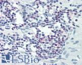 PLCG1 Antibody - Anti-PLCG1 antibody IHC of human colon, lymphocytes. Immunohistochemistry of formalin-fixed, paraffin-embedded tissue after heat-induced antigen retrieval. Antibody dilution 1:25.