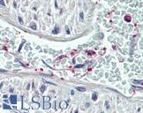 PLEK / Pleckstrin Antibody - Anti-Pleckstrin antibody IHC of human vessel, platelets. Immunohistochemistry of formalin-fixed, paraffin-embedded tissue after heat-induced antigen retrieval. Antibody concentration 75 ug/ml.