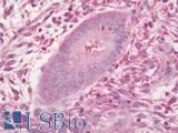 PLEKHA8 Antibody - Human Uterus, Endometrium: Formalin-Fixed, Paraffin-Embedded (FFPE)
