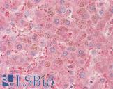 PLG / Plasmin / Plasminogen Antibody - Anti-PLG / Plasmin / Plasminogen antibody IHC staining of human liver. Immunohistochemistry of formalin-fixed, paraffin-embedded tissue after heat-induced antigen retrieval. Antibody concentration 5 ug/ml.
