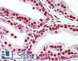 PLRG1 Antibody - Human Prostate: Formalin-Fixed, Paraffin-Embedded (FFPE)