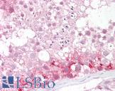 PMP70 Antibody - Anti-ABCD3 / PMP70 antibody IHC of human testis. Immunohistochemistry of formalin-fixed, paraffin-embedded tissue after heat-induced antigen retrieval. Antibody concentration 2.5 ug/ml.