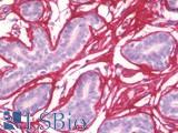 POSTN / Periostin Antibody - Human Breast: Formalin-Fixed, Paraffin-Embedded (FFPE)