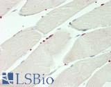 PRDM13 Antibody - Human Skeletal Muscle: Formalin-Fixed, Paraffin-Embedded (FFPE)