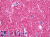 PRRT2 Antibody - Anti-PRRT2 antibody IHC staining of human brain, cerebellum. Immunohistochemistry of formalin-fixed, paraffin-embedded tissue after heat-induced antigen retrieval. Antibody concentration 10 ug/ml.