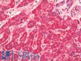 PS20 / WFDC1 Antibody - Human Liver: Formalin-Fixed, Paraffin-Embedded (FFPE)