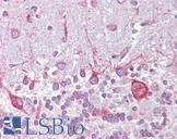 PSEN1 / Presenilin 1 Antibody - Anti-PSEN1 / Presenilin 1 antibody IHC of human brain, cerebellum. Immunohistochemistry of formalin-fixed, paraffin-embedded tissue after heat-induced antigen retrieval. Antibody concentration 5 ug/ml.  This image was taken for the unconjugated form of this product. Other forms have not been tested.