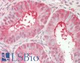 PSMA5 Antibody - Human Uterus: Formalin-Fixed, Paraffin-Embedded (FFPE)