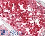 PSMB5 Antibody - Human Testis: Formalin-Fixed, Paraffin-Embedded (FFPE)