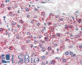 PSPH Antibody - Anti-PSPH antibody IHC of human liver. Immunohistochemistry of formalin-fixed, paraffin-embedded tissue after heat-induced antigen retrieval. Antibody concentration 10 ug/ml.