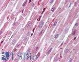 PTPN11 / SHP-2 / NS1 Antibody - Anti-PTPN11 antibody IHC of human heart. Immunohistochemistry of formalin-fixed, paraffin-embedded tissue after heat-induced antigen retrieval. Antibody concentration 5 ug/ml.