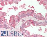 PVR / CD155 Antibody - Human Prostate: Formalin-Fixed, Paraffin-Embedded (FFPE)