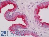 RAB27A / RAB27 Antibody - Human Prostate: Formalin-Fixed, Paraffin-Embedded (FFPE)