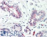 RAB34 Antibody - Anti-RAB34 antibody IHC of human breast. Immunohistochemistry of formalin-fixed, paraffin-embedded tissue after heat-induced antigen retrieval. Antibody dilution 5 ug/ml.