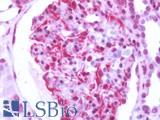 RAIG2 / GPRC5B Antibody - Human Kidney: Formalin-Fixed, Paraffin-Embedded (FFPE)