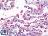 RALDH2 / ALDH1A2 Antibody - Anti-RALDH2 / ALDH1A2 antibody IHC staining of human lung. Immunohistochemistry of formalin-fixed, paraffin-embedded tissue after heat-induced antigen retrieval. Antibody dilution 1:100.