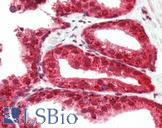 RASD2 Antibody - Anti-RASD2 antibody IHC of human prostate. Immunohistochemistry of formalin-fixed, paraffin-embedded tissue after heat-induced antigen retrieval. Antibody concentration 5 ug/ml.