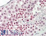 RBBP6 Antibody - Human Testis: Formalin-Fixed, Paraffin-Embedded (FFPE)