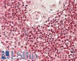 RBM27 Antibody - Human Spleen: Formalin-Fixed, Paraffin-Embedded (FFPE)