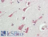 RCBTB1 Antibody - Human Brain, Cortex: Formalin-Fixed, Paraffin-Embedded (FFPE)