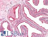 RGS18 Antibody - Human Prostate: Formalin-Fixed, Paraffin-Embedded (FFPE)