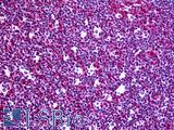 RGS3 Antibody - Anti-RGS3 antibody IHC of human tonsil. Immunohistochemistry of formalin-fixed, paraffin-embedded tissue after heat-induced antigen retrieval. Antibody concentration 5 ug/ml.