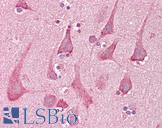 Rho Kinase / ROCK1 Antibody - Anti-ROCK1 antibody IHC of human brain, cortex. Immunohistochemistry of formalin-fixed, paraffin-embedded tissue after heat-induced antigen retrieval. Antibody concentration 5 ug/ml.