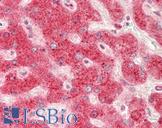 RHOB Antibody - Human Liver: Formalin-Fixed, Paraffin-Embedded (FFPE).  This image was taken for the unconjugated form of this product. Other forms have not been tested.