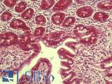 RILPL1 Antibody - Anti-RILPL1 antibody IHC staining of human small intestine. Immunohistochemistry of formalin-fixed, paraffin-embedded tissue after heat-induced antigen retrieval. Antibody concentration 5 ug/ml.