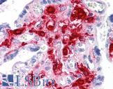 RNF144B Antibody - Anti-RNF144B antibody IHC of human placenta. Immunohistochemistry of formalin-fixed, paraffin-embedded tissue after heat-induced antigen retrieval. Antibody concentration 5 ug/ml.