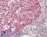 RNF182 Antibody - Human Tonsil: Formalin-Fixed, Paraffin-Embedded (FFPE)