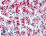 RNH1 Antibody - Anti-RNH1 antibody IHC of human liver. Immunohistochemistry of formalin-fixed, paraffin-embedded tissue after heat-induced antigen retrieval. Antibody concentration 5 ug/ml.
