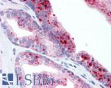 ROBO2 Antibody - Human Prostate: Formalin-Fixed, Paraffin-Embedded (FFPE)