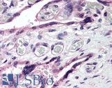 ROBO4 Antibody - Anti-ROBO4 antibody IHC of human placenta. Immunohistochemistry of formalin-fixed, paraffin-embedded tissue after heat-induced antigen retrieval. Antibody concentration 5 ug/ml.  This image was taken for the unconjugated form of this product. Other forms have not been tested.