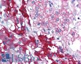 RPAIN Antibody - Anti-RPAIN antibody IHC of human adrenal. Immunohistochemistry of formalin-fixed, paraffin-embedded tissue after heat-induced antigen retrieval. Antibody concentration 5 ug/ml.