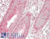 RPL35 / Ribosomal Protein L35 Antibody - Human Uterus: Formalin-Fixed, Paraffin-Embedded (FFPE)