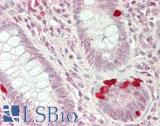 RPS7 / Ribosomal Protein S7 Antibody - Human Small Intestine: Formalin-Fixed, Paraffin-Embedded (FFPE)
