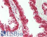 RRBP1 / hES Antibody - Human Prostate: Formalin-Fixed, Paraffin-Embedded (FFPE)
