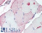 RXFP2 / LGR8 Antibody - Anti-RXFP2 antibody IHC of human skeletal muscle. Immunohistochemistry of formalin-fixed, paraffin-embedded tissue after heat-induced antigen retrieval.
