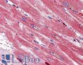 S100A4 / FSP1 Antibody - Anti-S100A4 antibody IHC of human heart. Immunohistochemistry of formalin-fixed, paraffin-embedded tissue after heat-induced antigen retrieval. Antibody concentration 5 ug/ml.