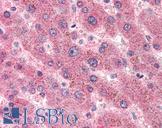 SAA1 / SAA / Serum Amyloid A Antibody - Anti-SAA1 / Serum Amyloid A antibody IHC of human liver. Immunohistochemistry of formalin-fixed, paraffin-embedded tissue after heat-induced antigen retrieval. Antibody concentration 5 ug/ml.