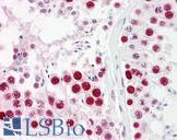 SAE2 / UBA2 Antibody - Anti-UBA2 antibody IHC of human testis. Immunohistochemistry of formalin-fixed, paraffin-embedded tissue after heat-induced antigen retrieval. Antibody dilution 1:100.