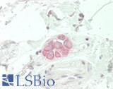 SCN10A / Nav1.8 Antibody - Human Colon, Myenteric Plexus: Formalin-Fixed, Paraffin-Embedded (FFPE)