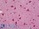 SCN1B Antibody - Human Brain, Cortex: Formalin-Fixed, Paraffin-Embedded (FFPE)