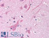 SCN5A / Nav1.5 Antibody - Anti-SCN5A / Nav1.5 antibody IHC of human brain, cortex. Immunohistochemistry of formalin-fixed, paraffin-embedded tissue after heat-induced antigen retrieval. Antibody concentration 10 ug/ml.